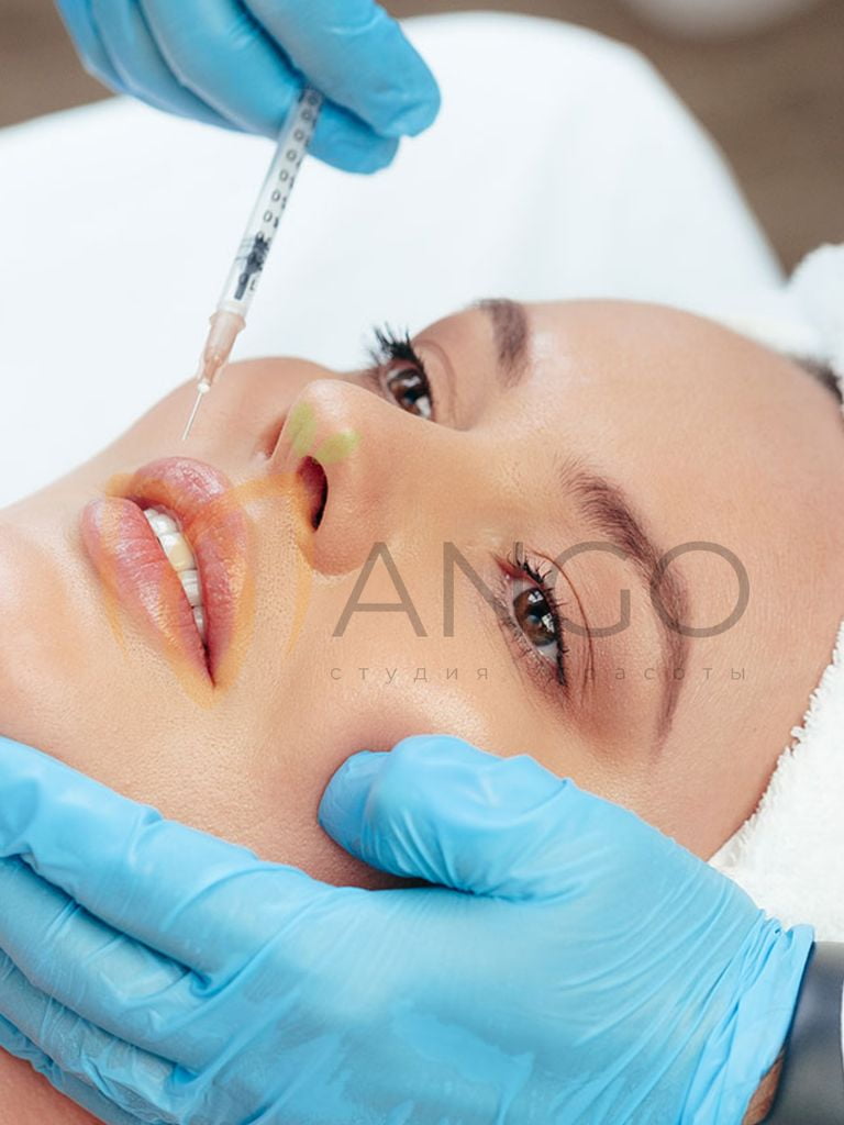 Инъекции препарата «Ботокс» в зоны на выбор