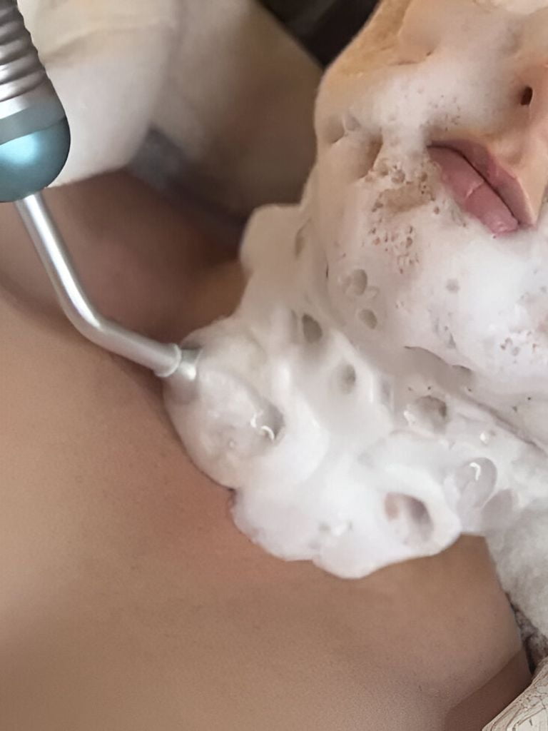 Водородная терапия лица Bubble Pen