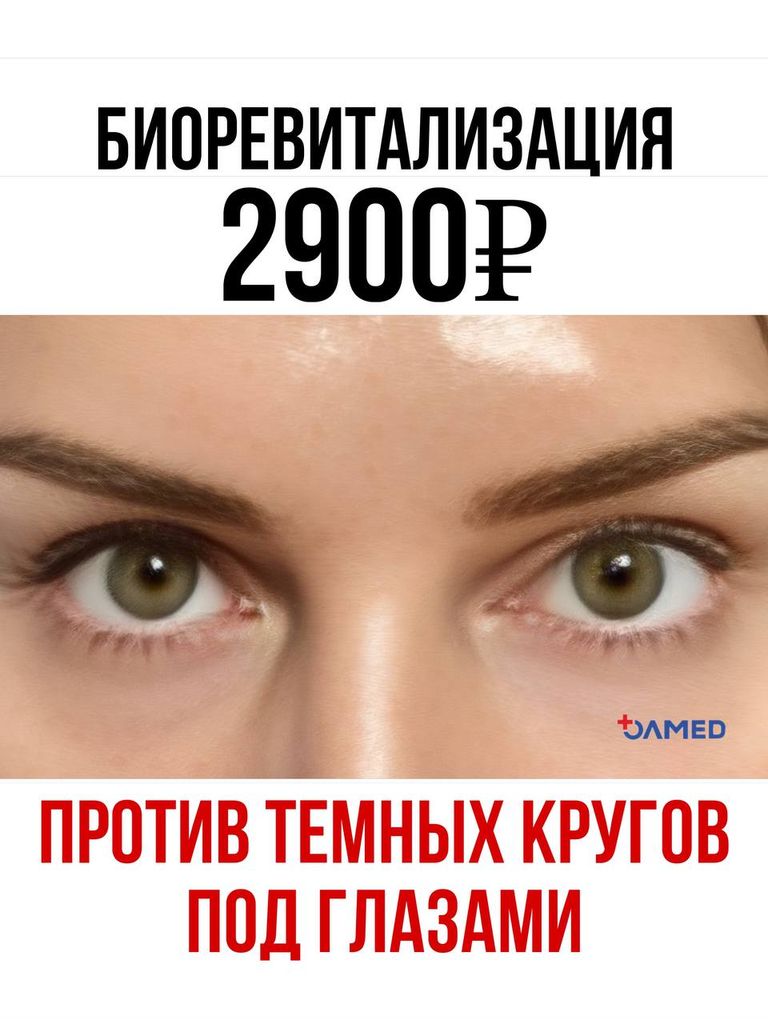 Инъекционная биоревитализация зоны вокруг глаз