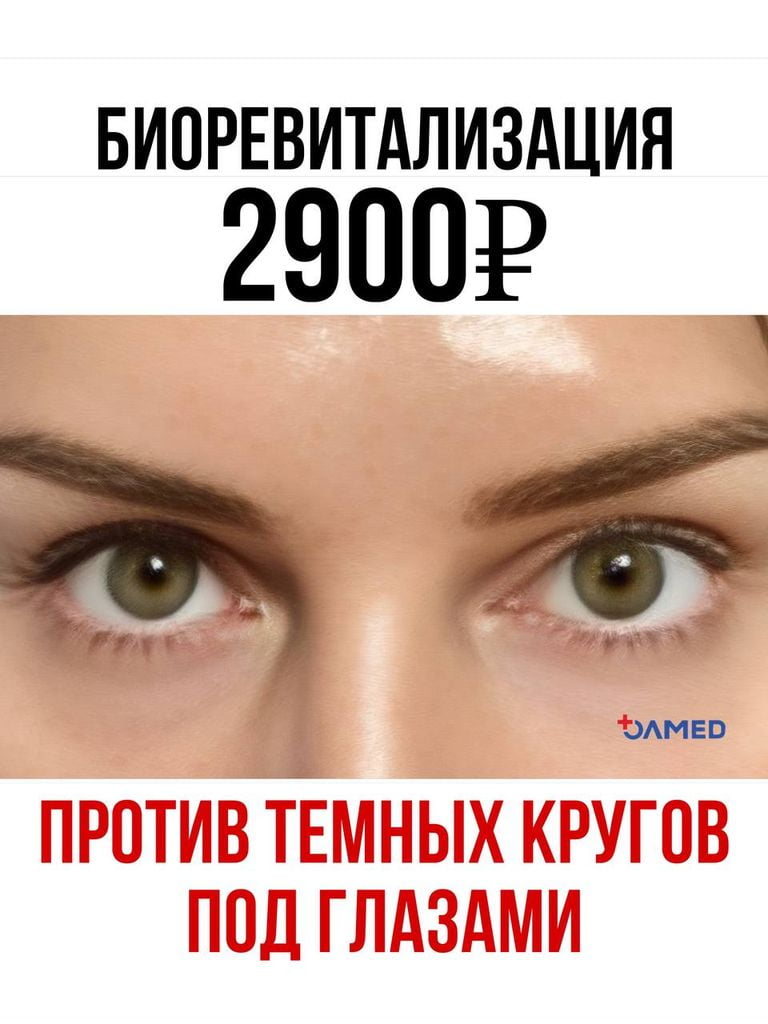 Инъекционная биоревитализация зоны вокруг глаз