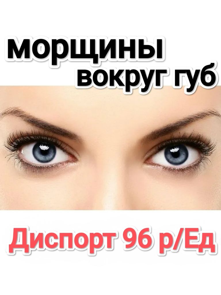 Инъекции препарата «Диспорт» вокруг губ