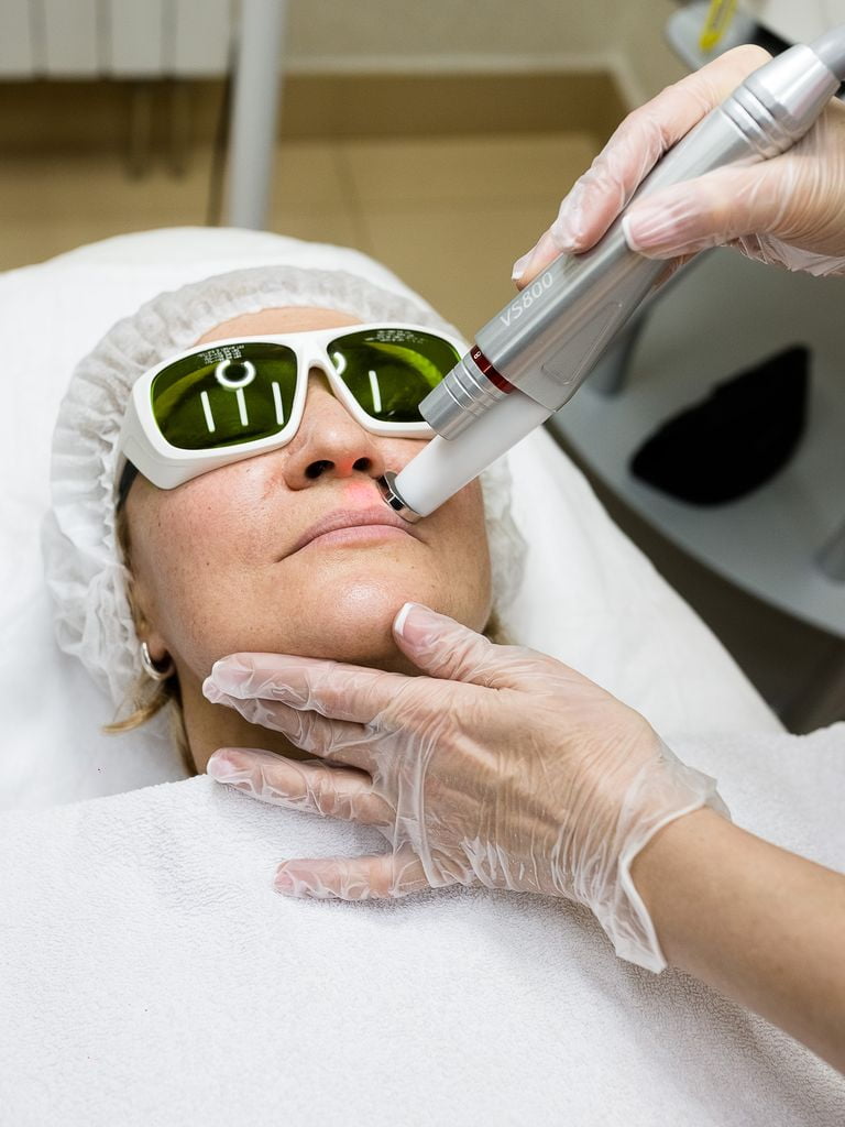 Лазерная эпиляция зон на выбор