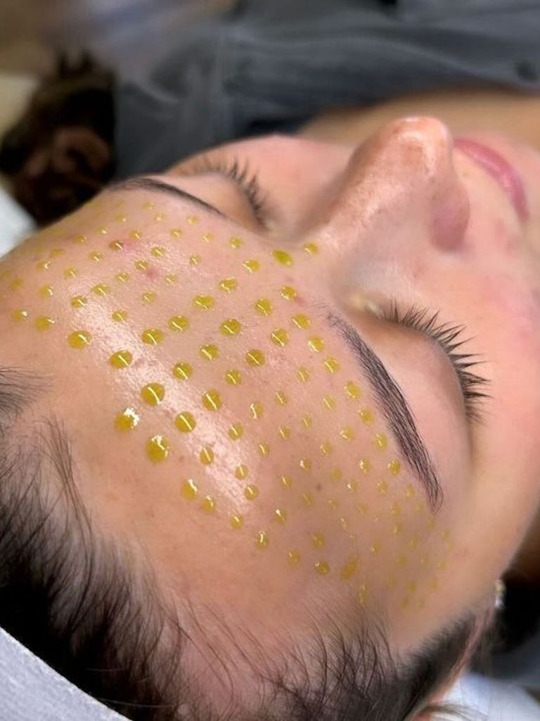 Пилинг лица BioRePeelCl3 (Италия) + Premium SPA-уход губ