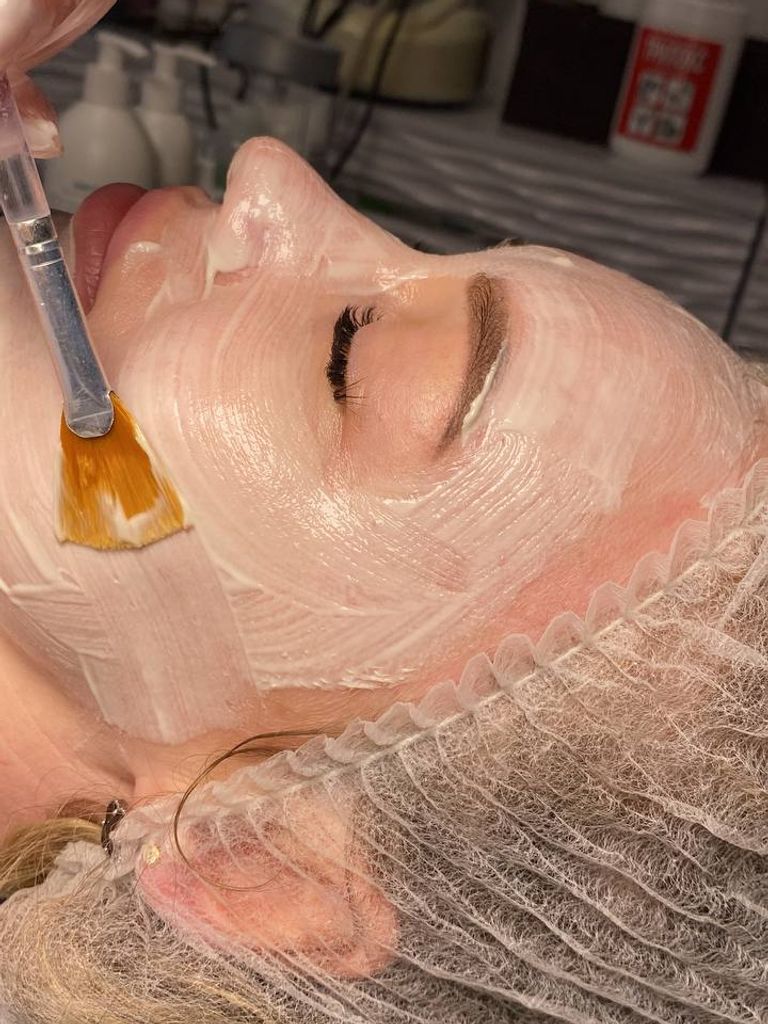 Микроигольчатый пилинг