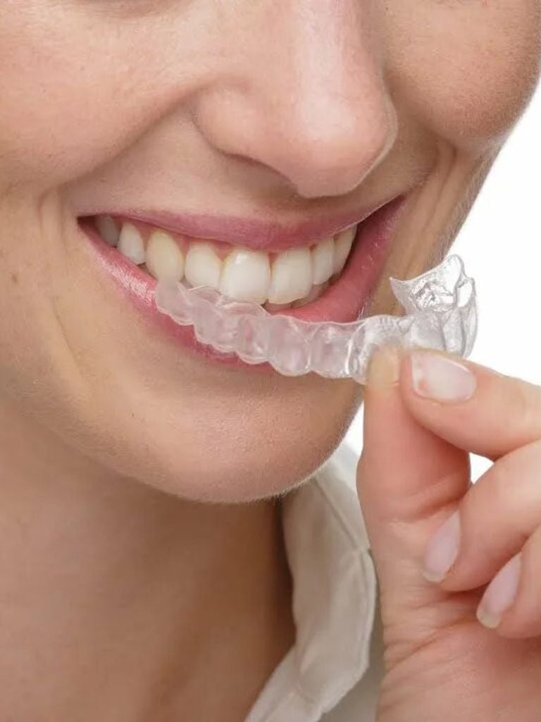 Профессиональное капповое отбеливание зубов (домашнее)