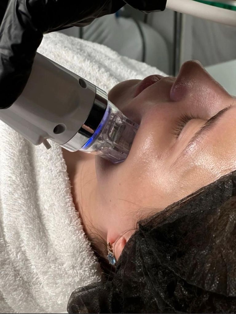 Микроигольчатый (фракционный) RF-лифтинг лица и шеи