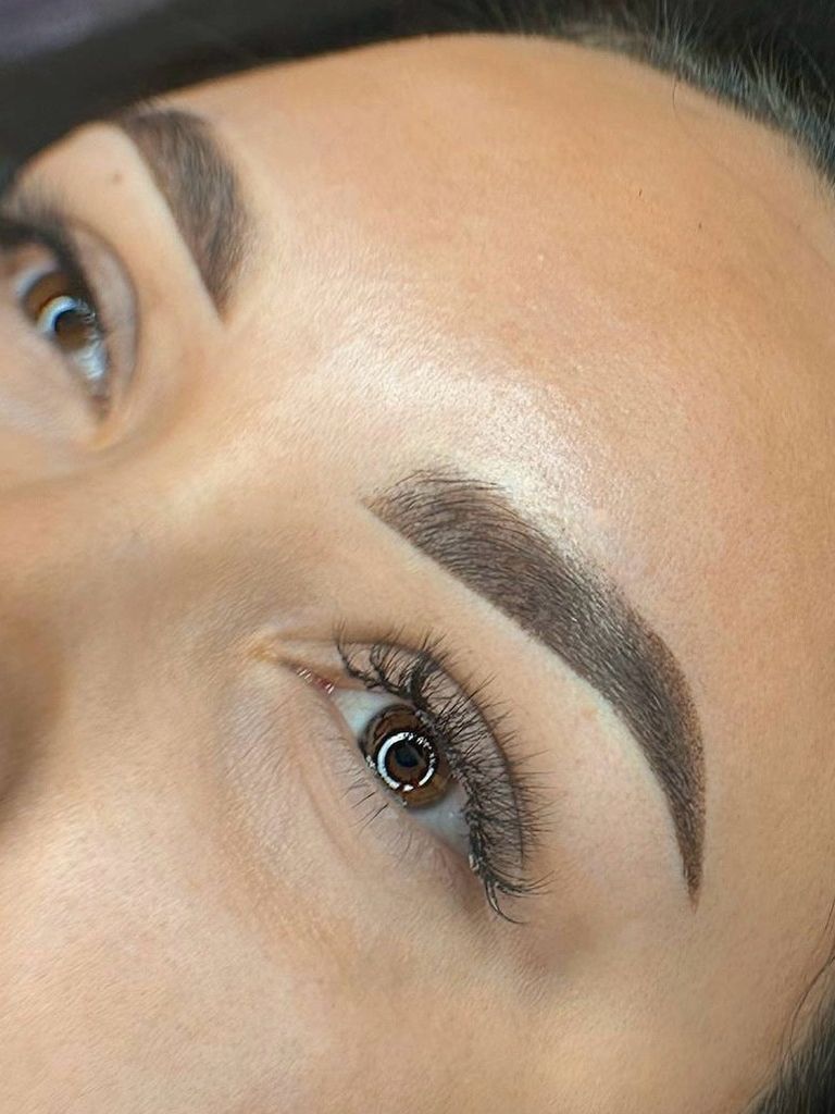 Лазерное удаление перманентного макияжа бровей