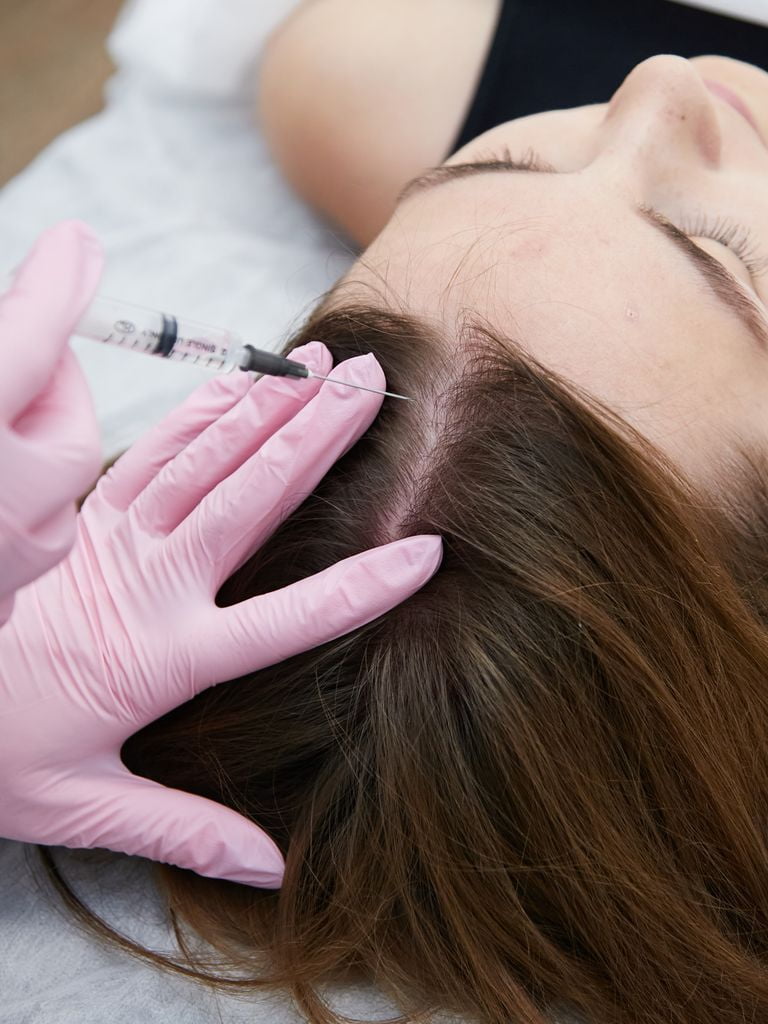 Мезотерапия для волос (первый сеанс)