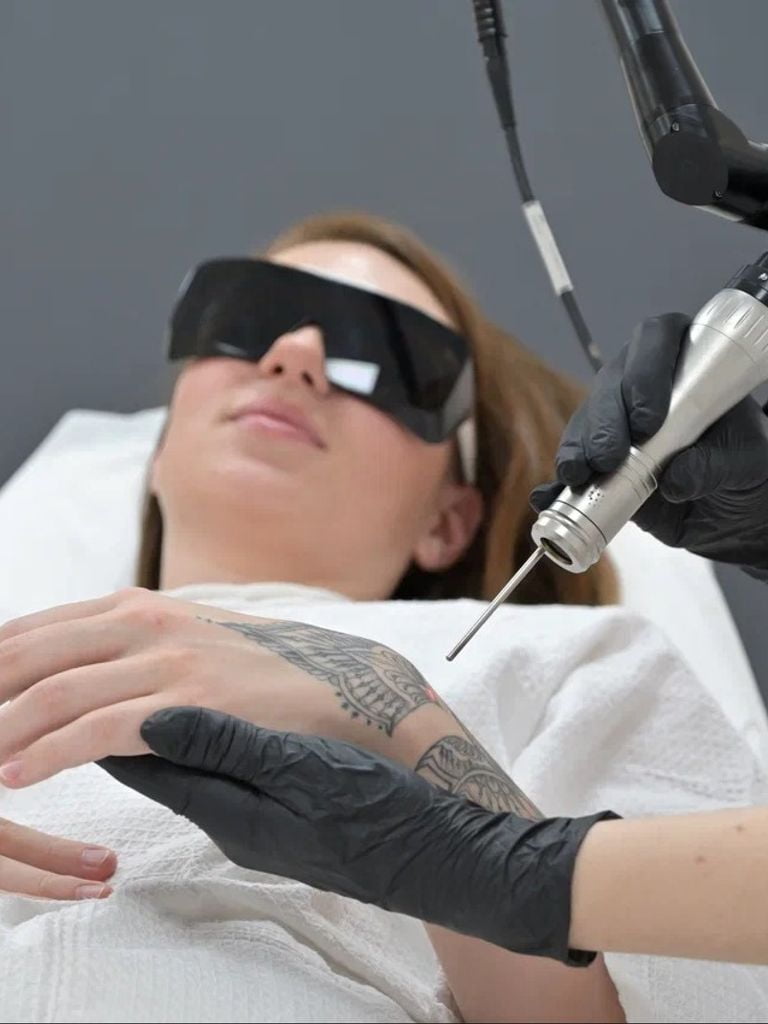 Удаление татуировок и татуажа