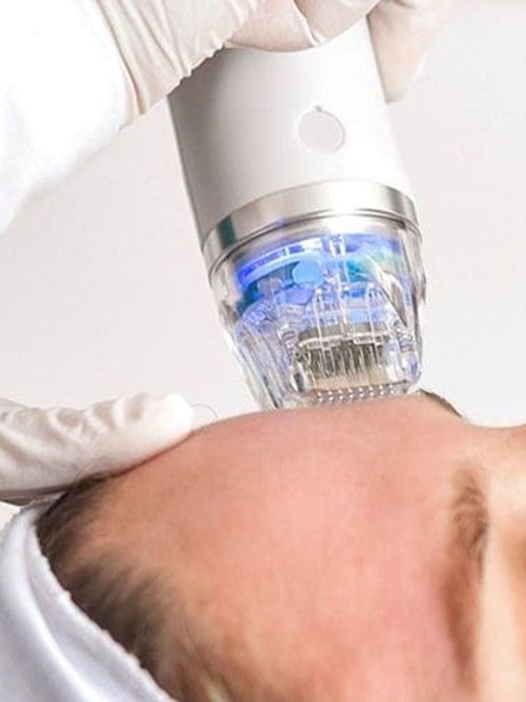 Микроигольчатый RF-лифтинг зон на выбор