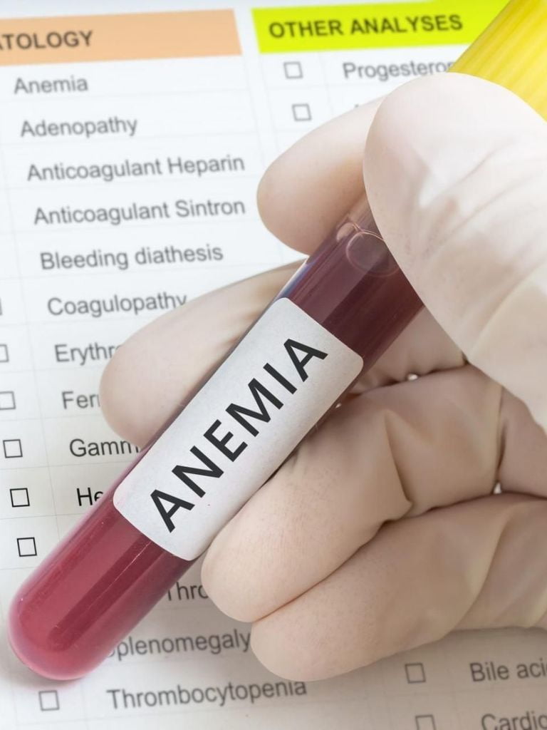 Комплекс «Диагностика анемии»