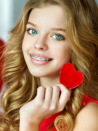 Металлические лигатурные брекеты на 1 челюсть