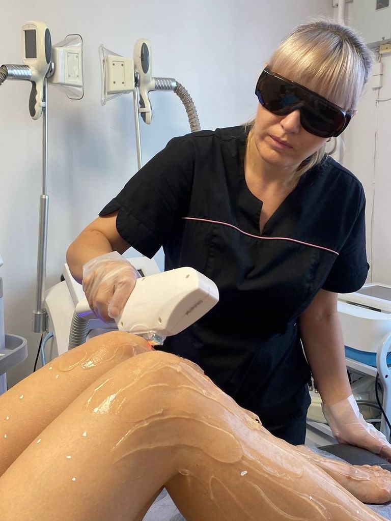 Лазерная эпиляция