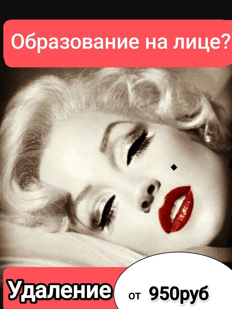 Удаление новообразований на лице до 3 мм.