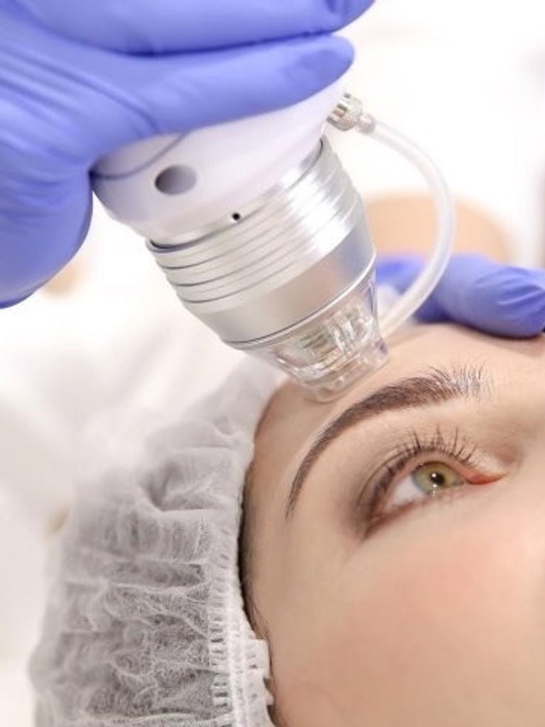 Фракционный (микроигольчатый) RF-лифтинг лица + шеи + зоны декольте