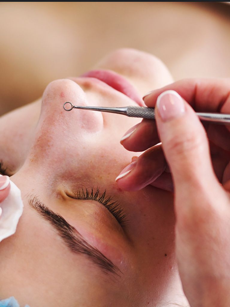 Механическая чистка лица