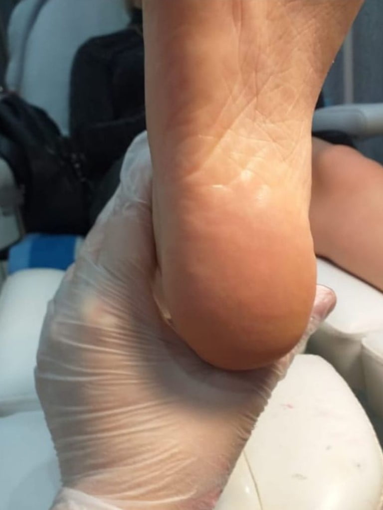 Полный Smart-педикюр (пальчики и стопа)