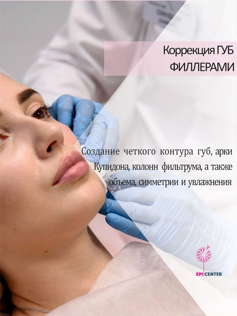 Коррекция губ филлерами на выбор