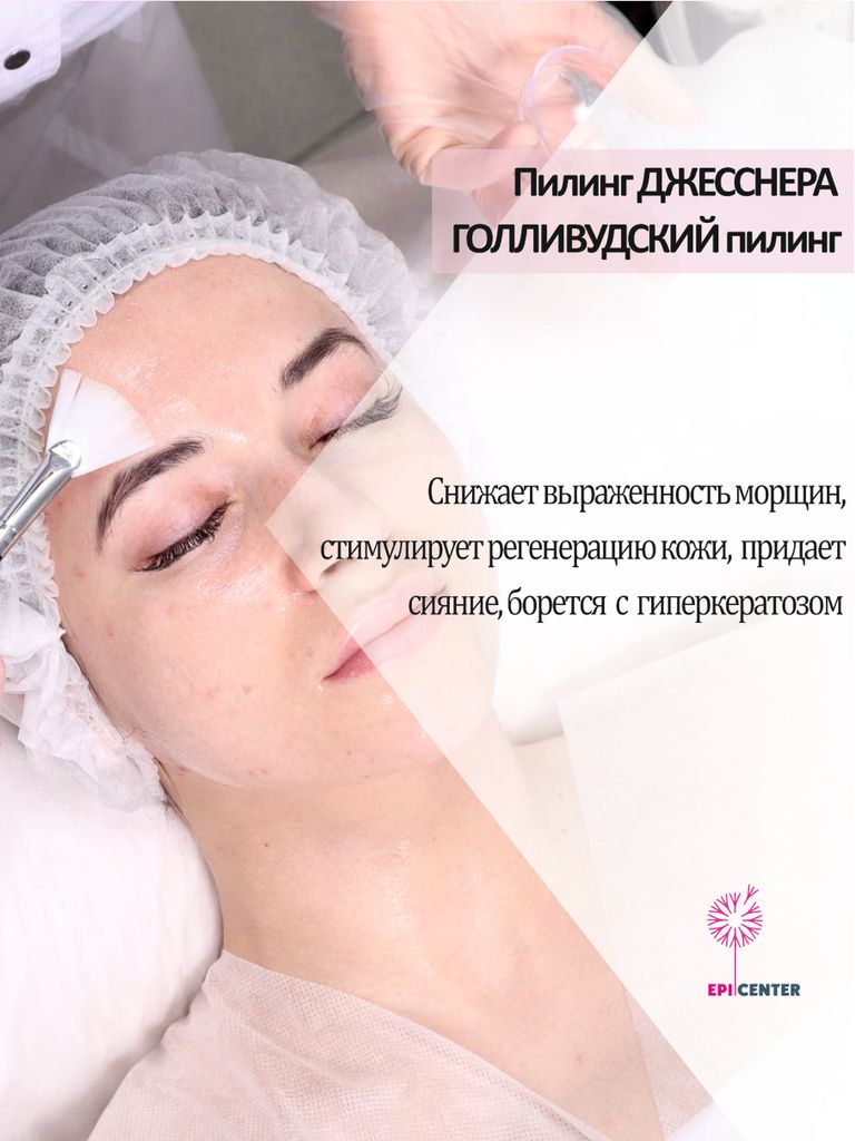 Пилинг Джесснера, «Голливудский пилинг»