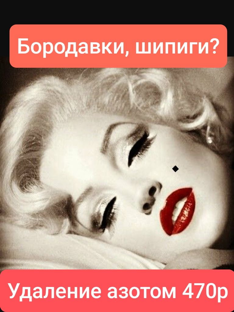 Удаление новообразований до 3 мм (метод криодеструкции)