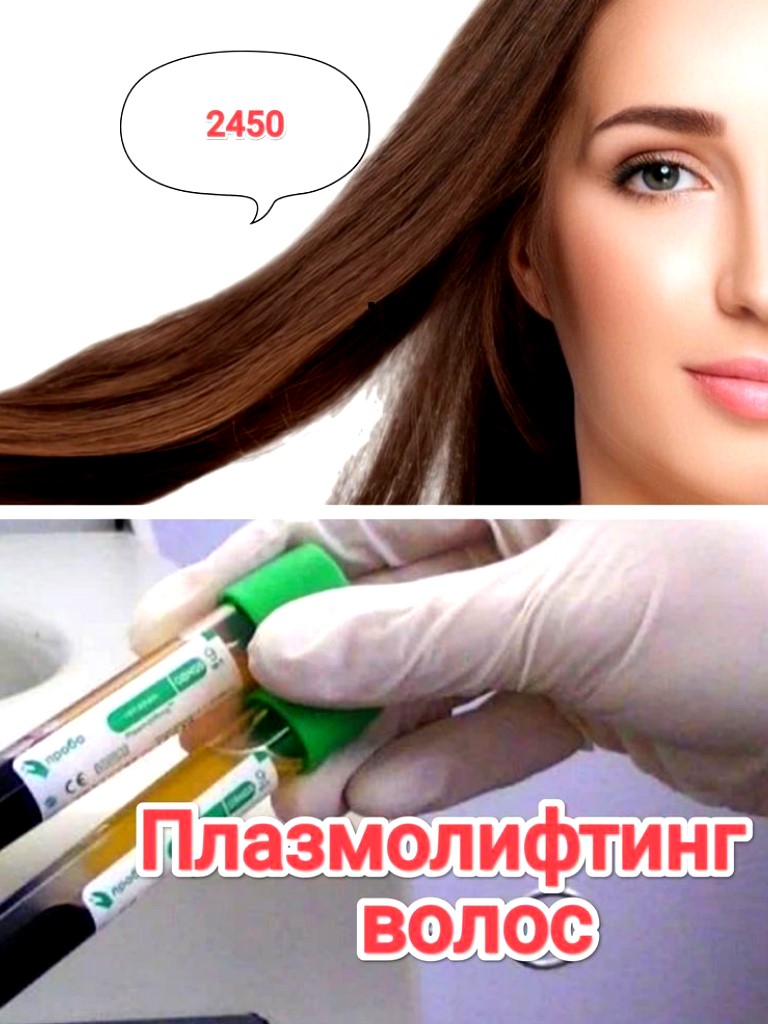 Плазмотерапия волосистой части головы (1 пробирка)