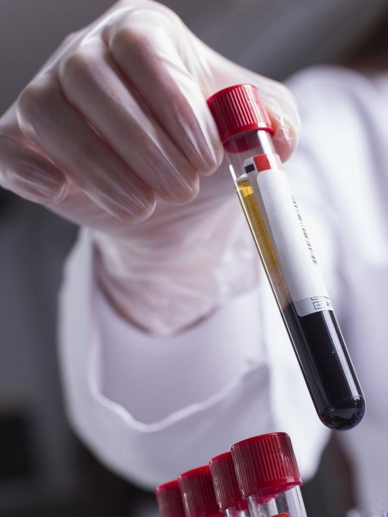 Анализ на паразиты, антитела IgG