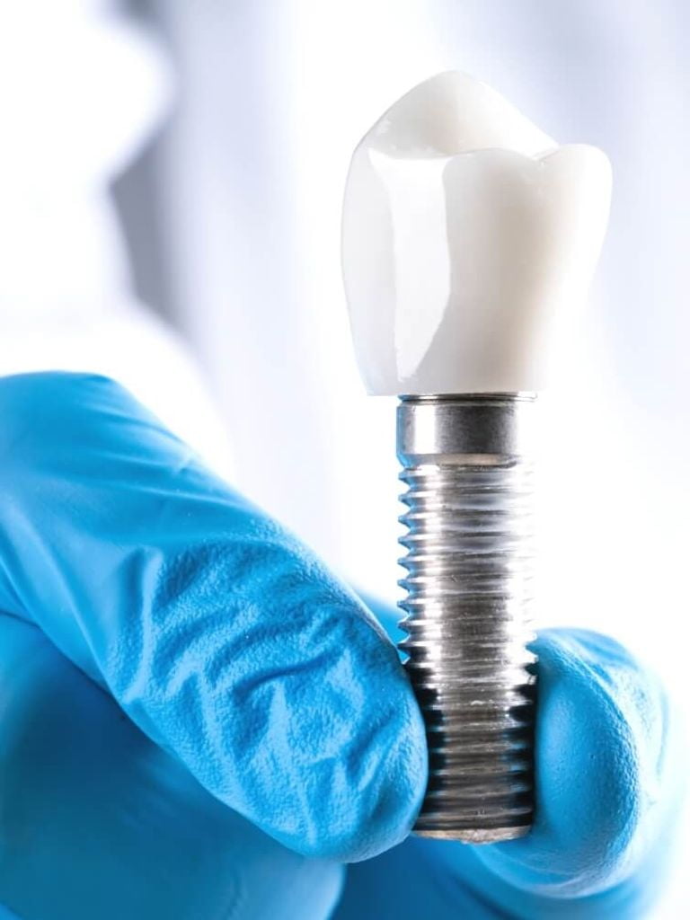 Подбор имплантов