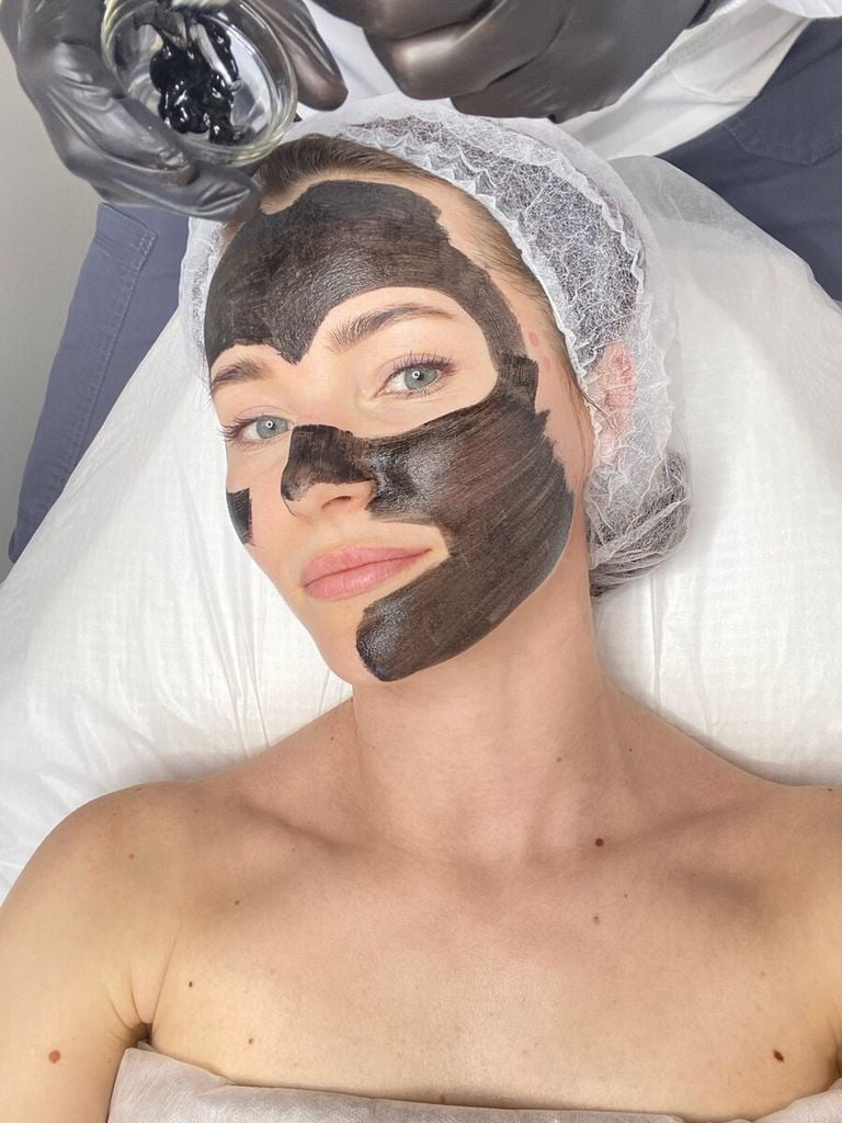 Карбоновый пилинг лица