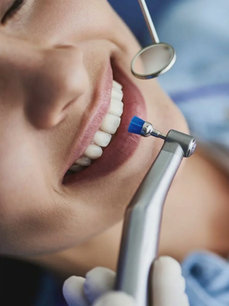 Профессиональная гигиена полости рта + Air Flow