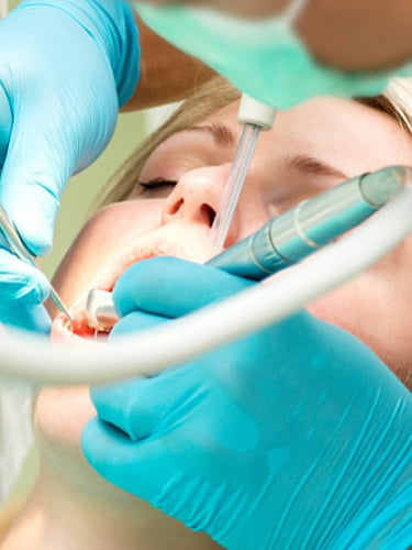 Удаление зуба