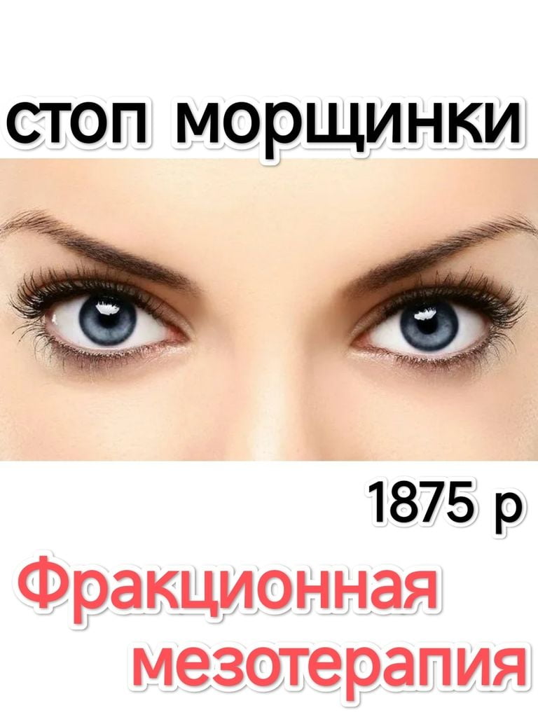 Дермапен (фракционная мезотерапия лица)