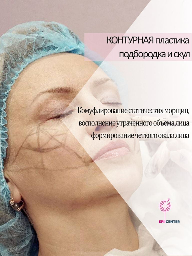 Контурная пластика подбородка или скул филлерами на выбор