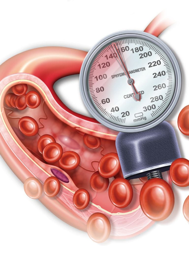 Лабораторное обследование при артериальной гипертензии