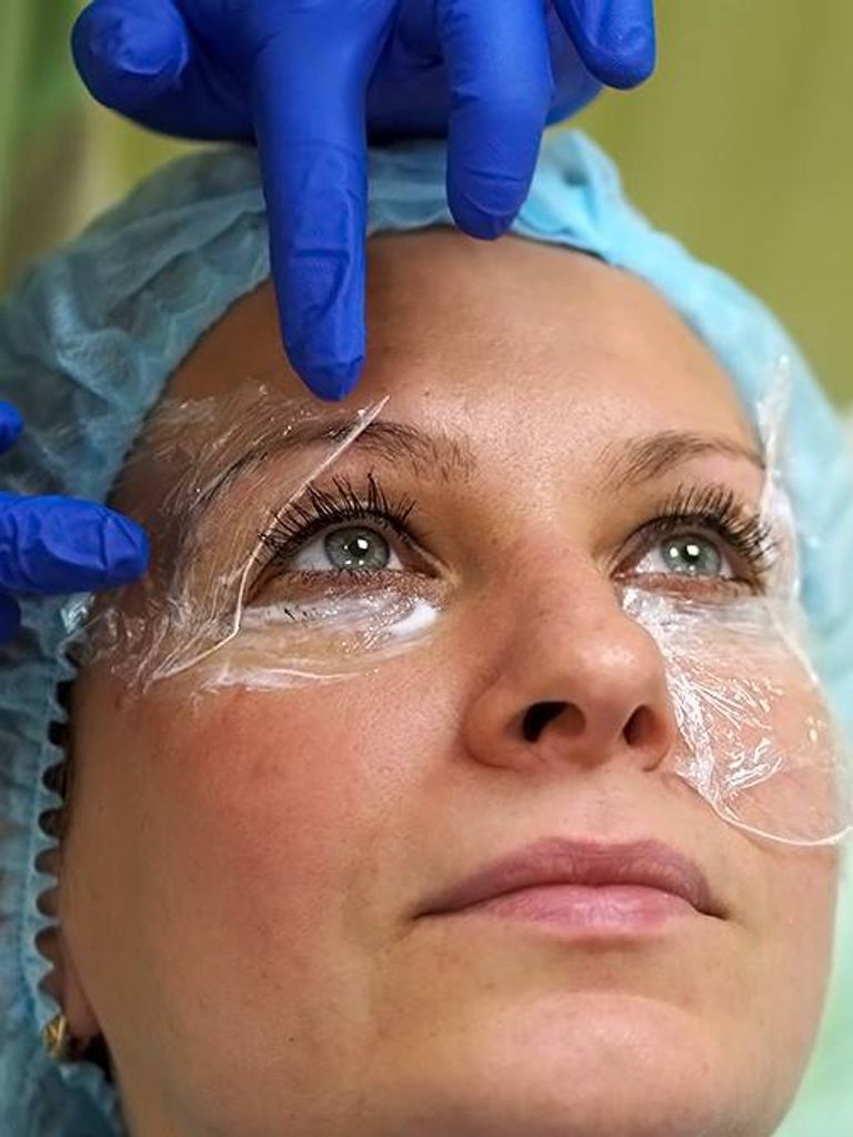 Нехирургическая блефаропластика, 30 мин.