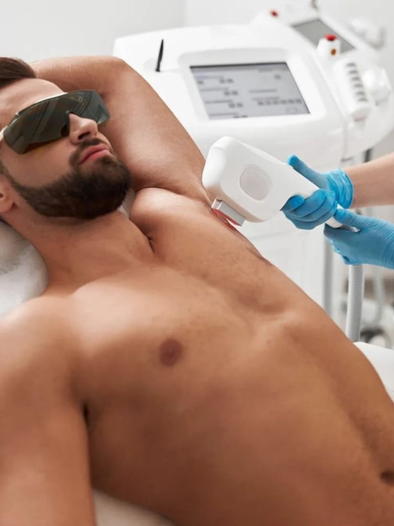 Лазерная эпиляция зон на выбор для мужчин