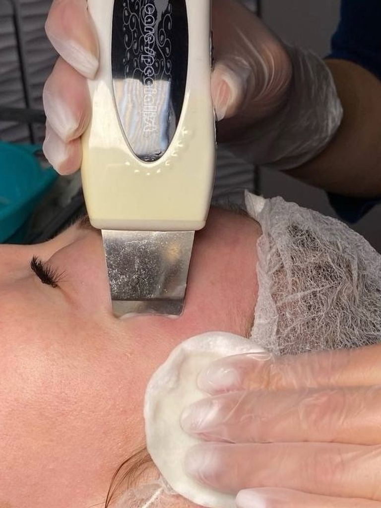 УЗ-чистка лица