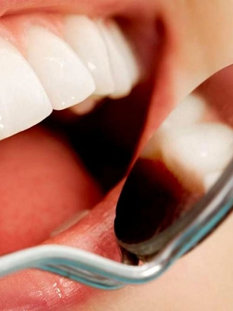 Эстетическая/художественная реставрация 1 зуба