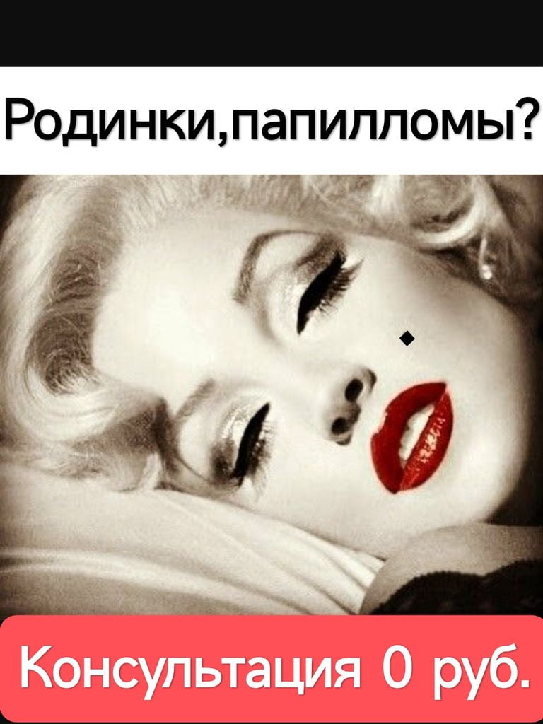 Консультация дерматолога по удалению новообразований