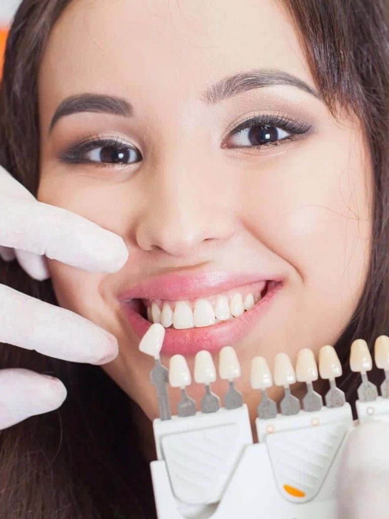 Профессиональное отбеливание зубов Amazing White