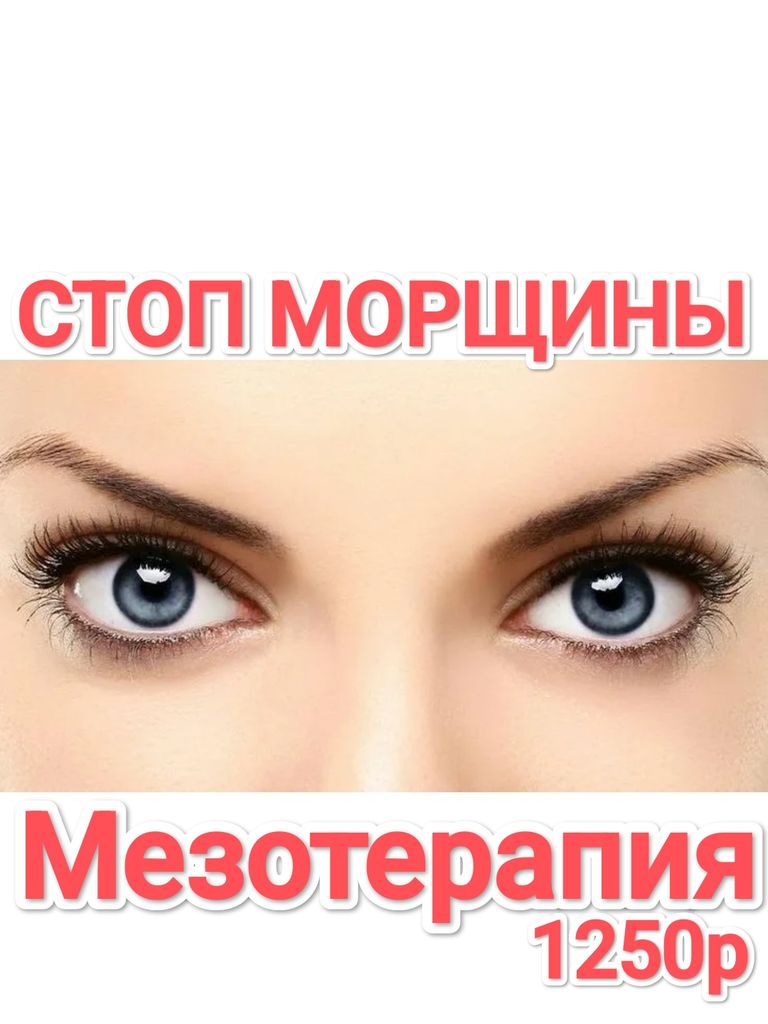 Инъекционная мезотерапия гиалуроновой кислотой, 1 мл
