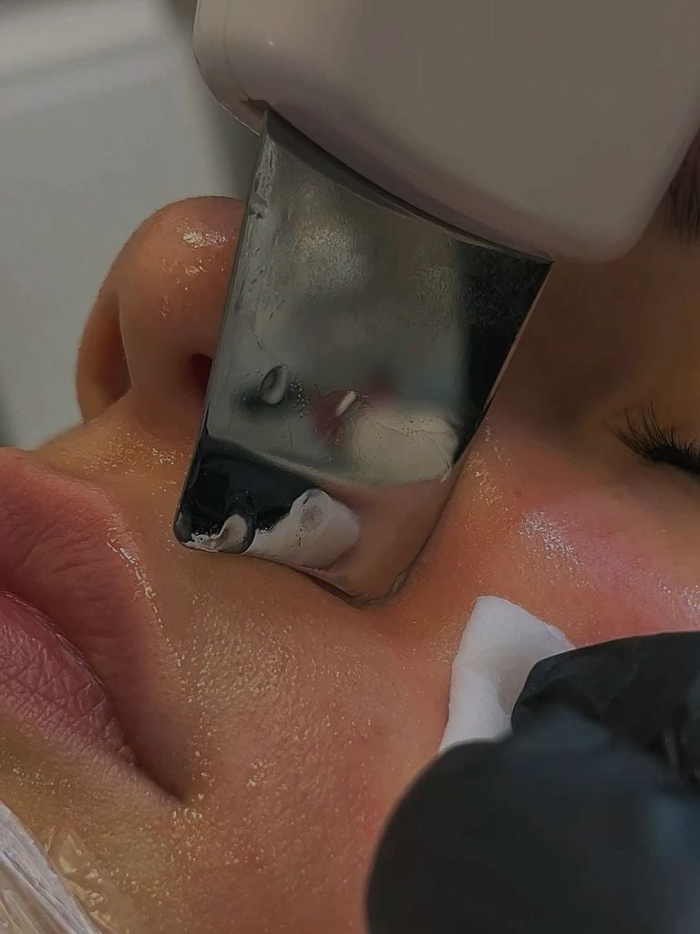 Подарочный сертификат на ультразвуковую чистку лица