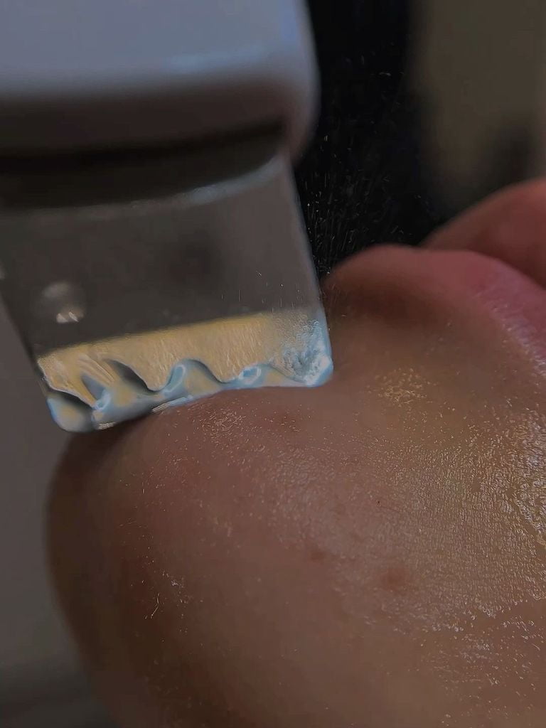 Ультразвуковая чистка