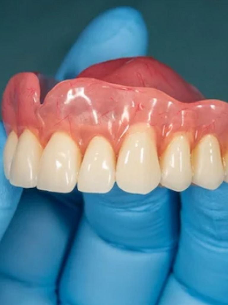 Изготовление полного съемного протеза Акри-фри (Бельгия)