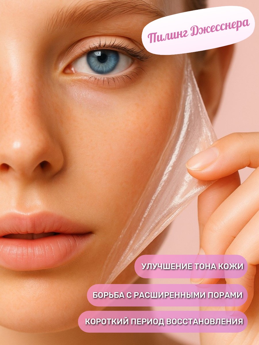 Пилинг Джесснера, 30 мин.