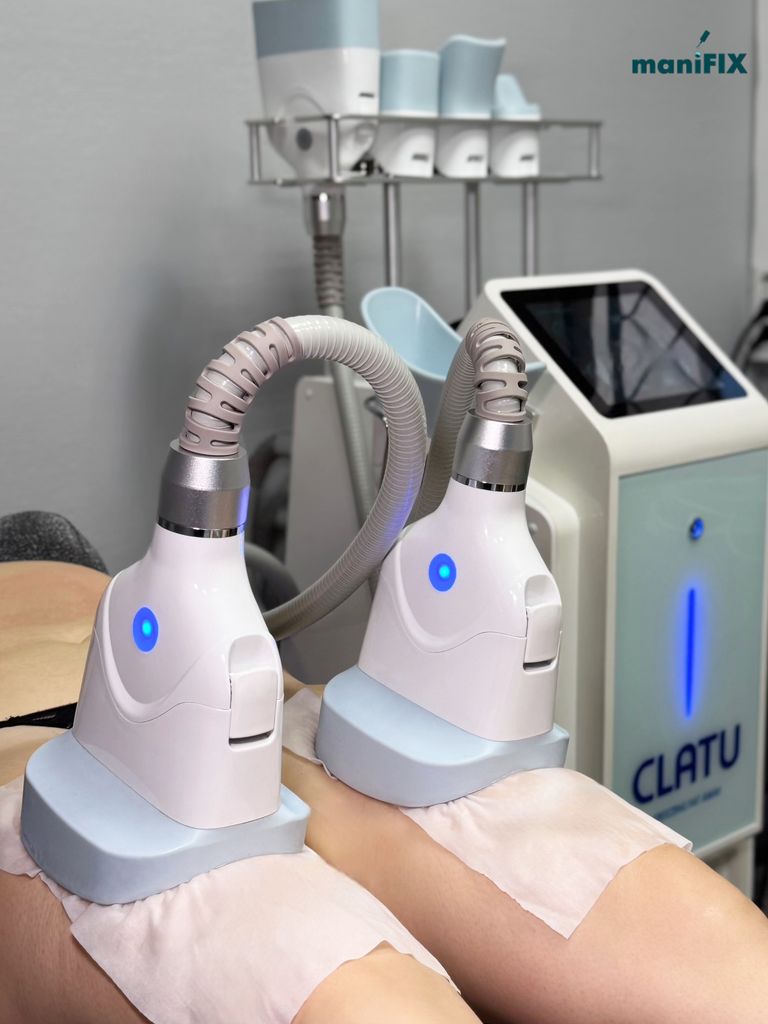 Криолиполиз (1 насадка), 55 мин.