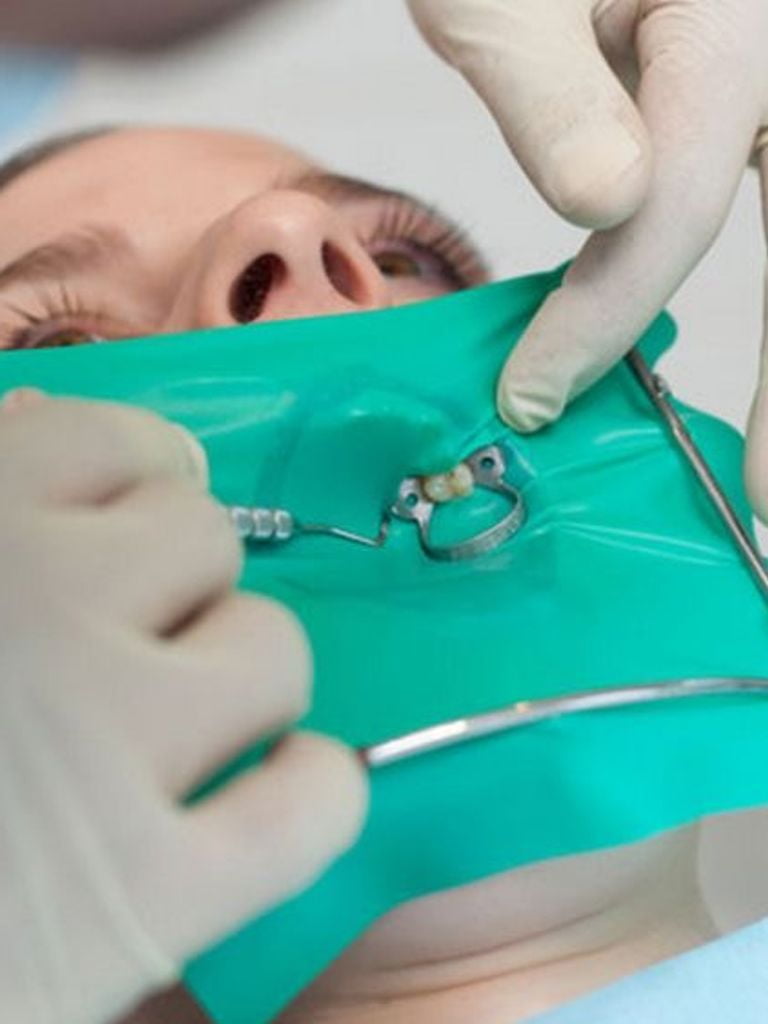 Лечение периодонтита