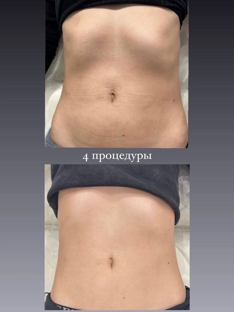 Комплекс «Коррекция фигуры», 30 мин.