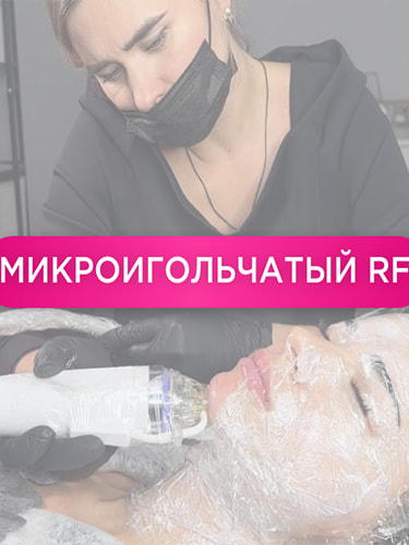 Микроигольчатый RF-лифтинг
