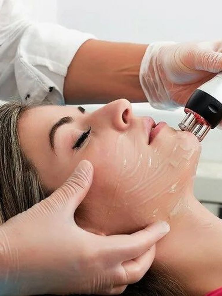 RF-лифтинг лица, 30 мин.