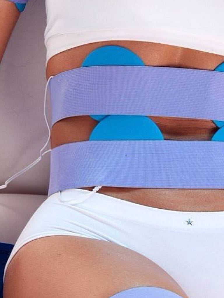 Миостимуляция